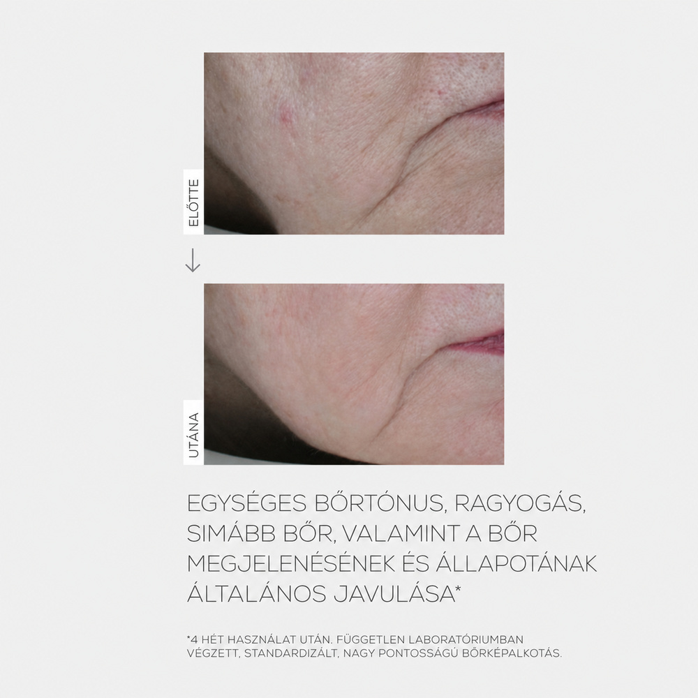 INFUSÍON LIFT Ragyogásfokozó Liftingkrém SPF30