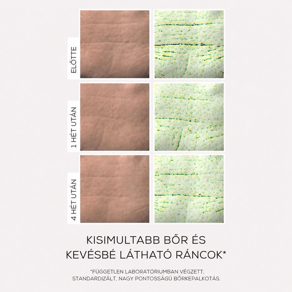 INFUSÍON LIFT Intenzíven Liftingelő Feszesítő Szérum