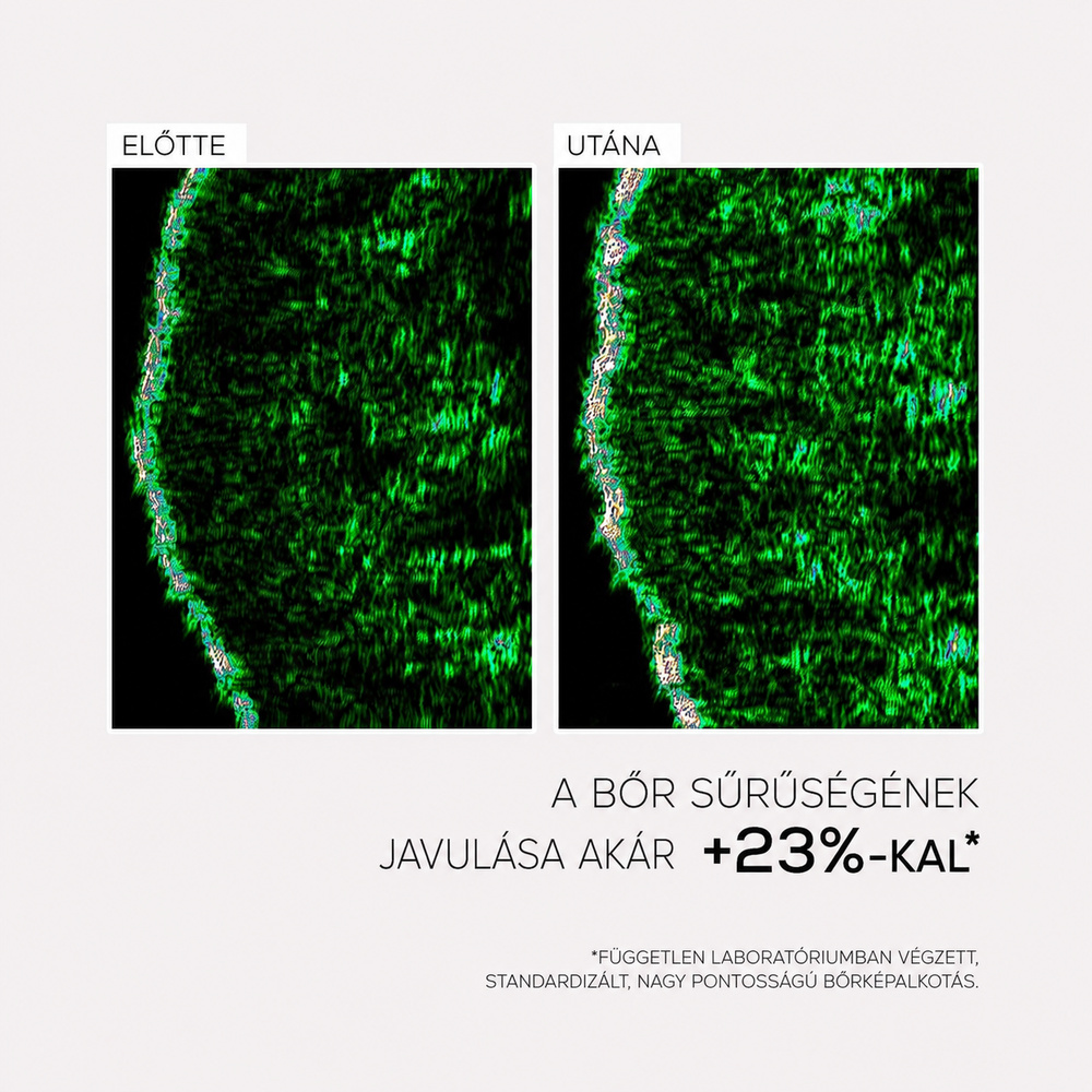 INFUSÍON LIFT Intenzíven Liftingelő Feszesítő Szérum